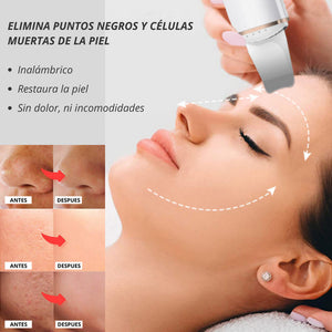 Limpiador facial inalámbrico para puntos negros